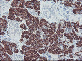 CPA2 Antibody - IHC of paraffin-embedded Human pancreas tissue using anti-CPA2 mouse monoclonal antibody.