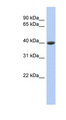 CPB / Carboxypeptidase B Antibody - CPB1 / Carboxypeptidase B antibody Western blot of COLO205 cell lysate. This image was taken for the unconjugated form of this product. Other forms have not been tested.