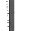 CPEB1 / CPEB Antibody - Western blot analysis of CPEB1 expression in A2058 cells lysate. The lane on the left is treated with the antigen-specific peptide.
