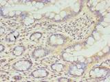 CPED1 Antibody - Immunohistochemistry of paraffin-embedded human small intestine tissue using antibody at dilution of 1:100.