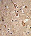 CPLX1 / Complexin 1 Antibody - Formalin-fixed and paraffin-embedded human brain tissue reacted with CPLX1 Antibody , which was peroxidase-conjugated to the secondary antibody, followed by DAB staining. This data demonstrates the use of this antibody for immunohistochemistry; clinical relevance has not been evaluated.