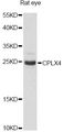 CPLX4 / Complexin IV Antibody - Western blot analysis of extracts of rat eye, using CPLX4 antibody at 1:3000 dilution. The secondary antibody used was an HRP Goat Anti-Rabbit IgG (H+L) at 1:10000 dilution. Lysates were loaded 25ug per lane and 3% nonfat dry milk in TBST was used for blocking. An ECL Kit was used for detection and the exposure time was 90s.