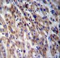 CPN1 Antibody - CPN1 Antibody immunohistochemistry of formalin-fixed and paraffin-embedded human liver tissue followed by peroxidase-conjugated secondary antibody and DAB staining.