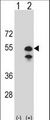 CPN1 Antibody - Western blot of CPN1 (arrow) using rabbit polyclonal CPN1 Antibody. 293 cell lysates (2 ug/lane) either nontransfected (Lane 1) or transiently transfected (Lane 2) with the CPN1 gene.