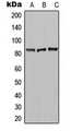 CPN2 Antibody - Western blot analysis of Carboxypeptidase N 2 expression in MCF7 (A); HeLa (B); Raw264.7 (C) whole cell lysates.