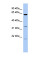 CPNE9 Antibody - CPNE9 antibody Western blot of 721_B cell lysate. This image was taken for the unconjugated form of this product. Other forms have not been tested.