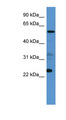 CPNE9 Antibody - CPNE9 antibody Western blot of 721_B cell lysate. This image was taken for the unconjugated form of this product. Other forms have not been tested.