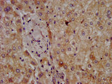 CPOX Antibody - IHC image of CPOX Antibody diluted at 1:300 and staining in paraffin-embedded human liver tissue performed on a Leica BondTM system. After dewaxing and hydration, antigen retrieval was mediated by high pressure in a citrate buffer (pH 6.0). Section was blocked with 10% normal goat serum 30min at RT. Then primary antibody (1% BSA) was incubated at 4°C overnight. The primary is detected by a biotinylated secondary antibody and visualized using an HRP conjugated SP system.