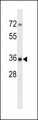 CPPED1 Antibody - CPPED1 Antibody western blot of ZR-75-1 cell line lysates (35 ug/lane). The CPPED1 antibody detected the CPPED1 protein (arrow).