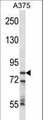 CPSF3 / CPSF Antibody - CPSF3 Antibody western blot of A375 cell line lysates (35 ug/lane). The CPSF3 antibody detected the CPSF3 protein (arrow).