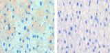 CPT1A Antibody - Left image is paraformaldehyde-fixed and paraffin-embedded cow lactating with CPT1A antibody , which was peroxidase-conjugated to the secondary antibody, followed by AEC staining, right image is contrast, did not add the antibody. This data was kindly offered by Hideaki Hayashi, University of Bern, Switzerland.