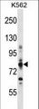 CPT1A Antibody - CPT1A Antibody western blot of K562 cell line lysates (35 ug/lane). The CPT1A antibody detected the CPT1A protein (arrow).