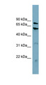CPT1B Antibody - CPT1B antibody Western blot of HT1080 cell lysate. This image was taken for the unconjugated form of this product. Other forms have not been tested.