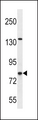 CPT1B Antibody - CPT1B Antibody western blot of SK-BR-3 cell line lysates (35 ug/lane). The CPT1B antibody detected the CPT1B protein (arrow).