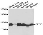 CPT1C Antibody - Western blot analysis of extracts of various cell lines, using CPT1C antibody at 1:3000 dilution. The secondary antibody used was an HRP Goat Anti-Rabbit IgG (H+L) at 1:10000 dilution. Lysates were loaded 25ug per lane and 3% nonfat dry milk in TBST was used for blocking. An ECL Kit was used for detection and the exposure time was 30s.