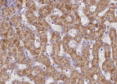 CPT2 Antibody - 1:100 staining human liver tissue by IHC-P. The tissue was formaldehyde fixed and a heat mediated antigen retrieval step in citrate buffer was performed. The tissue was then blocked and incubated with the antibody for 1.5 hours at 22°C. An HRP conjugated goat anti-rabbit antibody was used as the secondary.