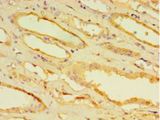CPVL Antibody - Immunohistochemistry of paraffin-embedded human kidney tissue using antibody at 1:100 dilution.  This image was taken for the unconjugated form of this product. Other forms have not been tested.