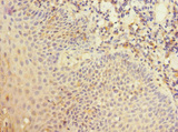 CR1 / CD35 Antibody - Immunohistochemistry of paraffin-embedded human tonsil tissue at dilution 1:100