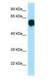 CR1L / CRRY Antibody - CR1L / CRRY antibody Western Blot of Fetal Brain.  This image was taken for the unconjugated form of this product. Other forms have not been tested.