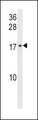 CR6 / GADD45G Antibody - GADD45G Antibody western blot of A549 cell line lysates (35 ug/lane). The GADD45G antibody detected the GADD45G protein (arrow).