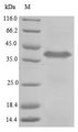 TPBG / 5T4 Protein - (Tris-Glycine gel) Discontinuous SDS-PAGE (reduced) with 5% enrichment gel and 15% separation gel.