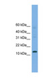 CRABP2 Antibody - CRABP2 antibody Western blot of PANC1 cell lysate. This image was taken for the unconjugated form of this product. Other forms have not been tested.