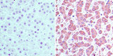 CRABP2 Antibody - IHC of CRABP2 in formalin-fixed, paraffin-embedded human liver tissue using an isotype control (left) and Polyclonal Antibody to CRABP2 (right) at 5 ug/ml.