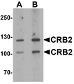 CRB2 Antibody - Western blot analysis of CRB2 in rat brain tissue lysate with CRB2 antibody at 1 ug/ml