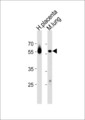 CREB3L2 / BBF2H7 Antibody - CREB3L2 Antibody western blot of human placenta and mouse lung tissue lysates (35 ug/lane). The CREB3L2 antibody detected the CREB3L2 protein (arrow).