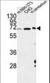 CREBL1 / ATF6B Antibody - CREBL1 Antibody western blot of mouse NIH-3T3,CHO cell line and mouse cerebellum tissue lysates (35 ug/lane). The CREBL1 antibody detected the CREBL1 protein (arrow).