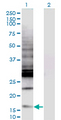 CREBL2 Antibody - Western Blot analysis of CREBL2 expression in transfected 293T cell line by CREBL2 monoclonal antibody (M04), clone 1C1.Lane 1: CREBL2 transfected lysate (Predicted MW: 13.8 KDa).Lane 2: Non-transfected lysate.
