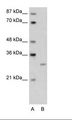 CREG / CREG1 Antibody - A: Marker, B: Transfected 293T Cell Lysate.  This image was taken for the unconjugated form of this product. Other forms have not been tested.