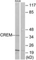 CREM / ICER Antibody - Western blot analysis of lysates from RAW264.7 cells, using CREM Antibody. The lane on the right is blocked with the synthesized peptide.