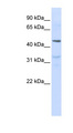 CRF2-12 / IL28RA Antibody - IL28RA antibody Western blot of Jurkat lysate. This image was taken for the unconjugated form of this product. Other forms have not been tested.