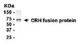 CRH / CRF Antibody - E coli-derived fusion protein as test antigen. CRH / CRF Antibody dilution: 1:2000, Goat anti-IgY-HRP dilution: 1:1000. Colorimetric method for signal development.