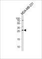 CRISP1 Antibody - Western blot of lysate from MDA-MB-231 cell line, using CRISP1 Antibody. Antibody was diluted at 1:1000 at each lane. A goat anti-rabbit IgG H&L (HRP) at 1:5000 dilution was used as the secondary antibody. Lysate at 35ug per lane.