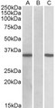 CRISP2 / TSP1 Antibody - HEK293 lysate (10ug protein in RIPA buffer) overexpressing Human CRISP2 (RC205312) with C-terminal MYC tag probed with (0.11ug/ml) in Lane A and probed with anti-MYC Tag (1/1000) in lane C. Mock-transfected HEK293 probed (1mg/ml) in L