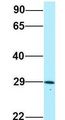 CRISP3 Antibody - CRISP3 / CRISP-3 antibody Western Blot of Human Placenta. Antibody Dilution: 1.0 ug/ml. Antibody dilution: 1 ug/ml.  This image was taken for the unconjugated form of this product. Other forms have not been tested.