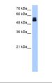 CRISPLD2 Antibody - Jurkat cell lysate. Antibody concentration: 1.0 ug/ml. Gel concentration: 12%.  This image was taken for the unconjugated form of this product. Other forms have not been tested.