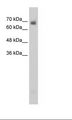 CRMP1 Antibody - HepG2 Cell Lysate.  This image was taken for the unconjugated form of this product. Other forms have not been tested.