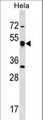 CRTAP Antibody - CRTAP Antibody western blot of HeLa cell line lysates (35 ug/lane). The CRTAP antibody detected the CRTAP protein (arrow).