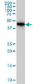 CRTAP Antibody - CRTAP monoclonal antibody (M01), clone 4D9 Western blot of CRTAP expression in HeLa.