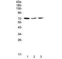 CRTC2 / TORC2 Antibody - Western blot testing of human 1) HeLa, 2) MCF7 and 3) A375 cell lysate with TORC2 antibody at 0.5ug/ml. Predicted molecular weight ~73 kDa.