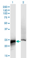CRYBB2 Antibody - Western Blot analysis of CRYBB2 expression in transfected 293T cell line by CRYBB2 monoclonal antibody (M02), clone 1F1.Lane 1: CRYBB2 transfected lysate (Predicted MW: 23.4 KDa).Lane 2: Non-transfected lysate.