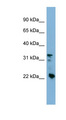 CRYBB3 Antibody - CRYBB3 antibody Western blot of HT1080 cell lysate. This image was taken for the unconjugated form of this product. Other forms have not been tested.
