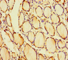 CRYGN Antibody - Immunohistochemistry of paraffin-embedded human thyroid tissue using CRYGN Antibody at dilution of 1:100