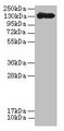Crystal Protein cry1Ac Antibody - Western blot All lanes: Kurstaki Pesticidal crystal protein cry1Ac antibody at 2µg/ml + recombinant Kurstaki Pesticidal crystal protein cry1Ac protein at 1µgSecondary Goat polyclonal to rabbit IgG at 1/10000 dilution Predicted band size: 133 kDa Observed band size: 133 kDa