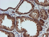 CRYZL1 Antibody - IHC of paraffin-embedded Human prostate tissue using anti-CRYZL1 mouse monoclonal antibody. (Heat-induced epitope retrieval by 10mM citric buffer, pH6.0, 100C for 10min).
