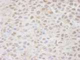 CSE1L Antibody - Detection of Mouse CSE1 by Immunohistochemistry. Sample: FFPE section of mouse squamous cell carcinoma. Antibody: Affinity purified rabbit anti-CSE1 used at a dilution of 1:100.