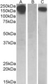 CSF1R / CD115 / FMS Antibody - HEK293 lysate (10ug protein in RIPA buffer) overexpressing Human CSF1R with C-terminal MYC tag probed with (0.5ug/ml) in Lane A and probed with anti-MYC Tag (1/1000) in lane C. Mock-transfected HEK293 probed (1mg/ml) in Lane B. Primar